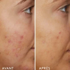 Sérums*Sunday Riley B3 Nice 10% Niacinamide Sérum Rééquilibrant