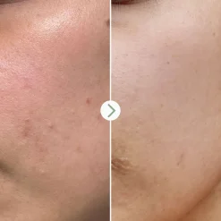 Sérums*Pai Skincare Booster Tri-Mushroom 10% Apaisant