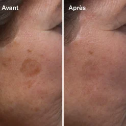 Sérums*Odacité Clean-ical Brightening Serum Sérum Éclaircissant