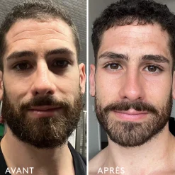 Compléments Alimentaires|Peau*Oh My Cream Skincare Complément Alimentaire Repulpant