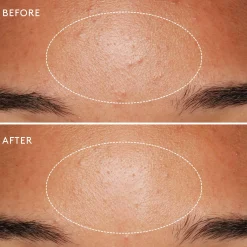 Tailles Voyage|Exfoliants & Gommages*Dermalogica Daily Microfoliant Exfoliant Poudre