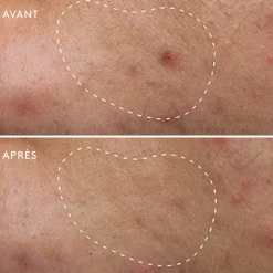 Soins Ciblés*Dermalogica Deep Breakout Liquid Patch Anti-Imperfections