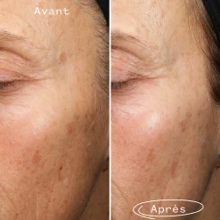 Sérums*Pai Skincare Fade Forward Sérum Anti-Taches