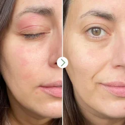 Contour Des Yeux & Lèvres*Pai Skincare Feather Canyon Crème Regard Anti-Âge