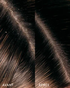 Huiles*Ceremonia Huile Remède Cuir Chevelu Aceite de Moska