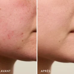 Bases De Teint|Soins Ciblés*Violette_FR Invisible Bandage Gel Apaisant & Réparateur