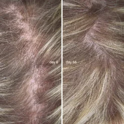 Compléments Alimentaires|Cheveux*Combeau L'Essentiel Cheveux Cure de 3 mois