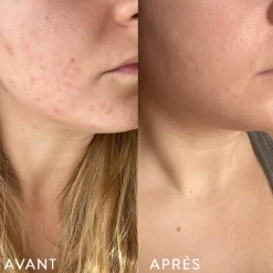 Peau|Digestion*Atelier Nubio Microbiote & Peau