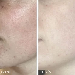 Exfoliants & Gommages|Sérums*Herbivore Botanicals Milky Way Sérum Exfoliant 10% Acide Lactique