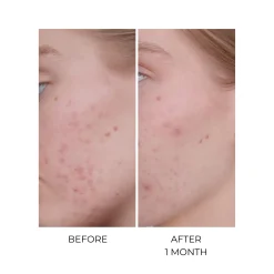 Compléments Alimentaires|Cheveux*Oskia MSM Bio-Plus